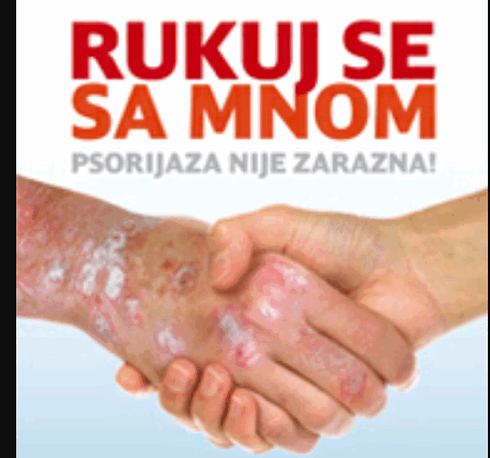 MEĐUNARODNI DAN PSORIJAZE  29.10.2018.